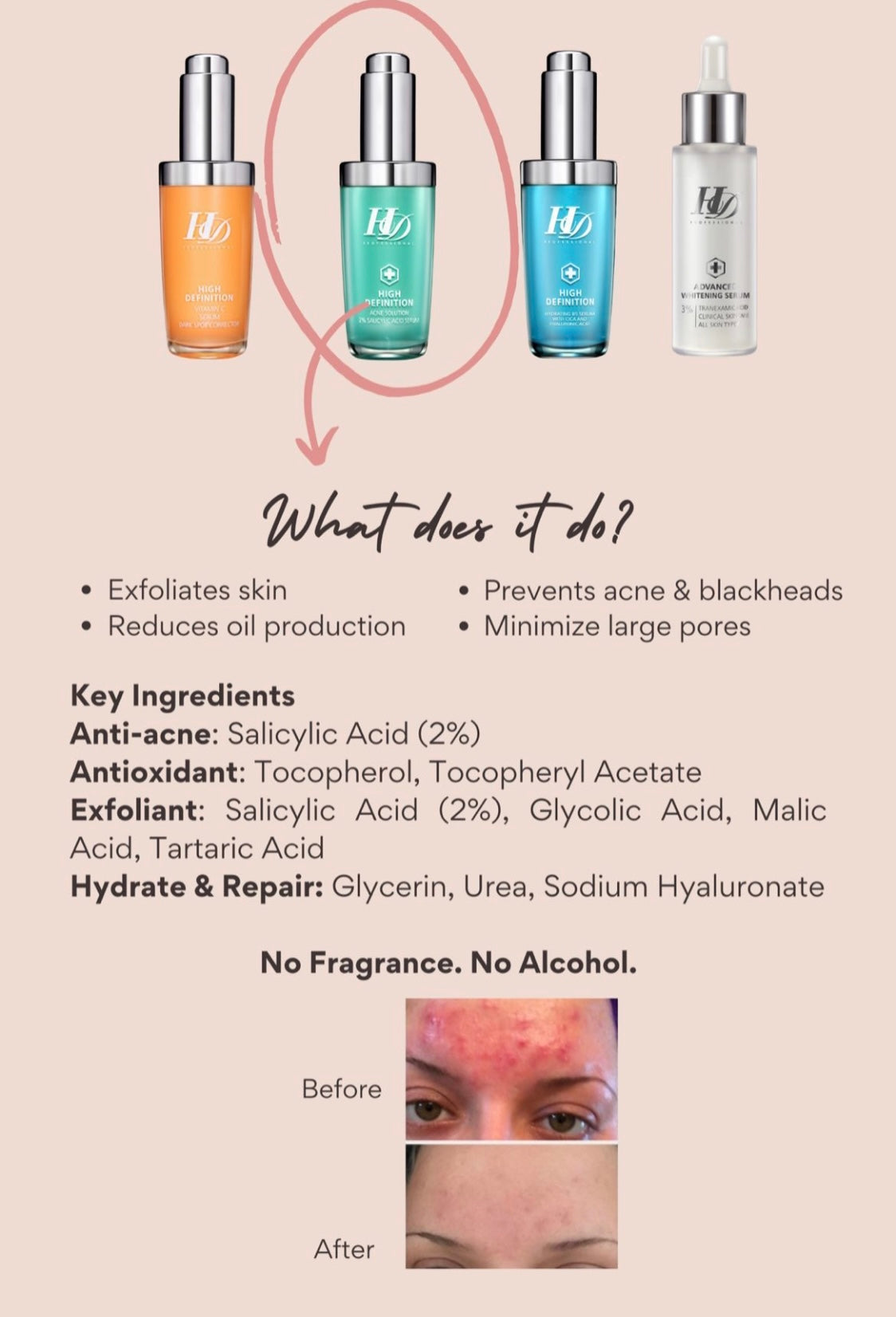 HD 2% SALICYLIC ACID SERUM 30ml