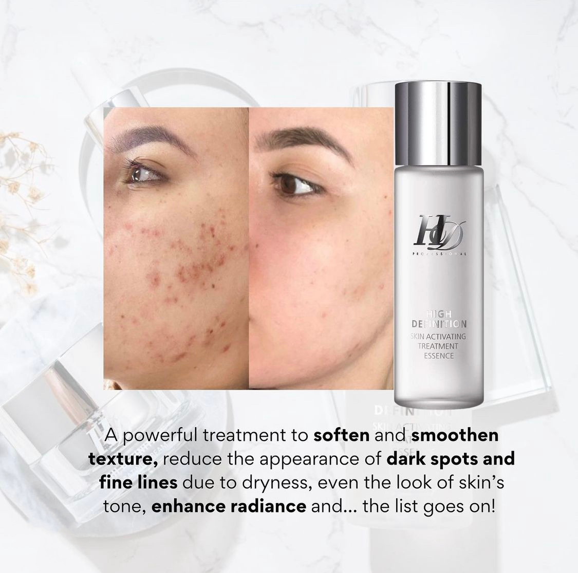 HD SKIN ACTIVATING TREATMENT ESSENCE 150ml